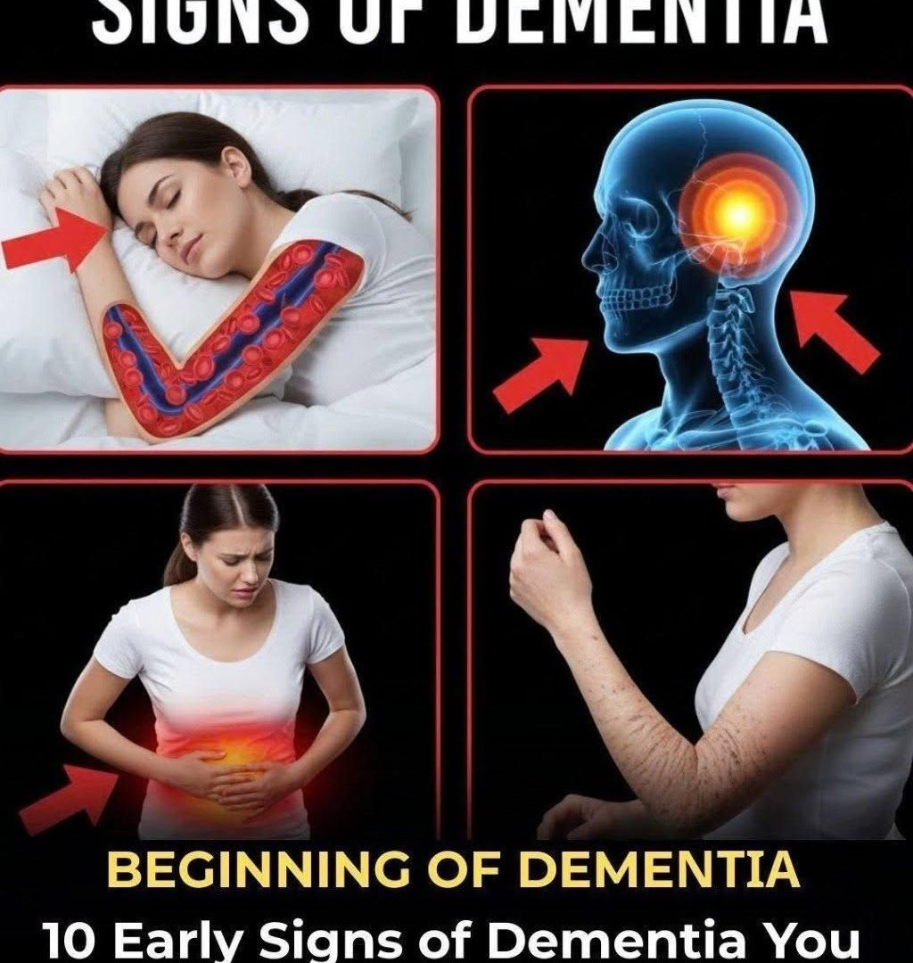 10 Early Signs of Dementia You Should Never Ignore 800642756_2210969909471853_1848975404872073484_n