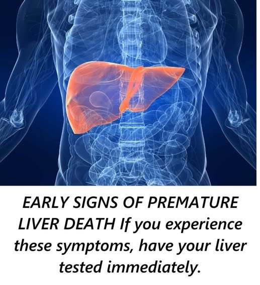 Early Signs of Premature Liver Death: If You Experience These Symptoms, Have Your Liver Tested Immediately 825267993_1090436947080697_7741580693508990431_n