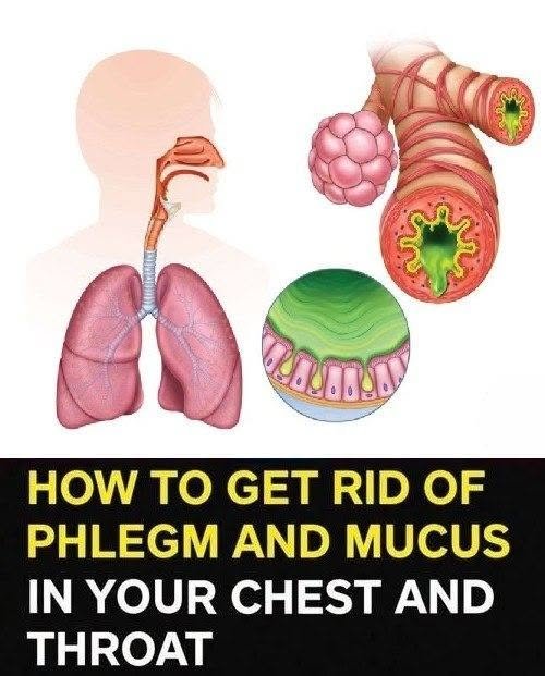 "HOW TO GET RID OF PHLEGM AND MUCUS IN YOUR CHEST AND THROAT." 829320993_1081631854470047_1085052659068336937_n