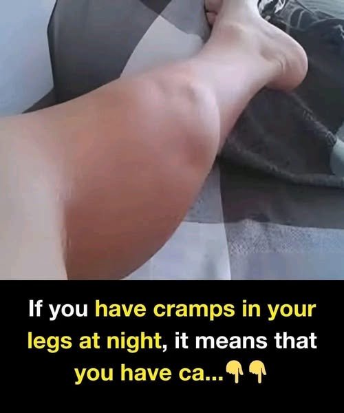 Who Is Most at Risk of Night Cramps? (And What the "Ca..." Really Means) 853766441_122196070046385538_5676079242391519121_n